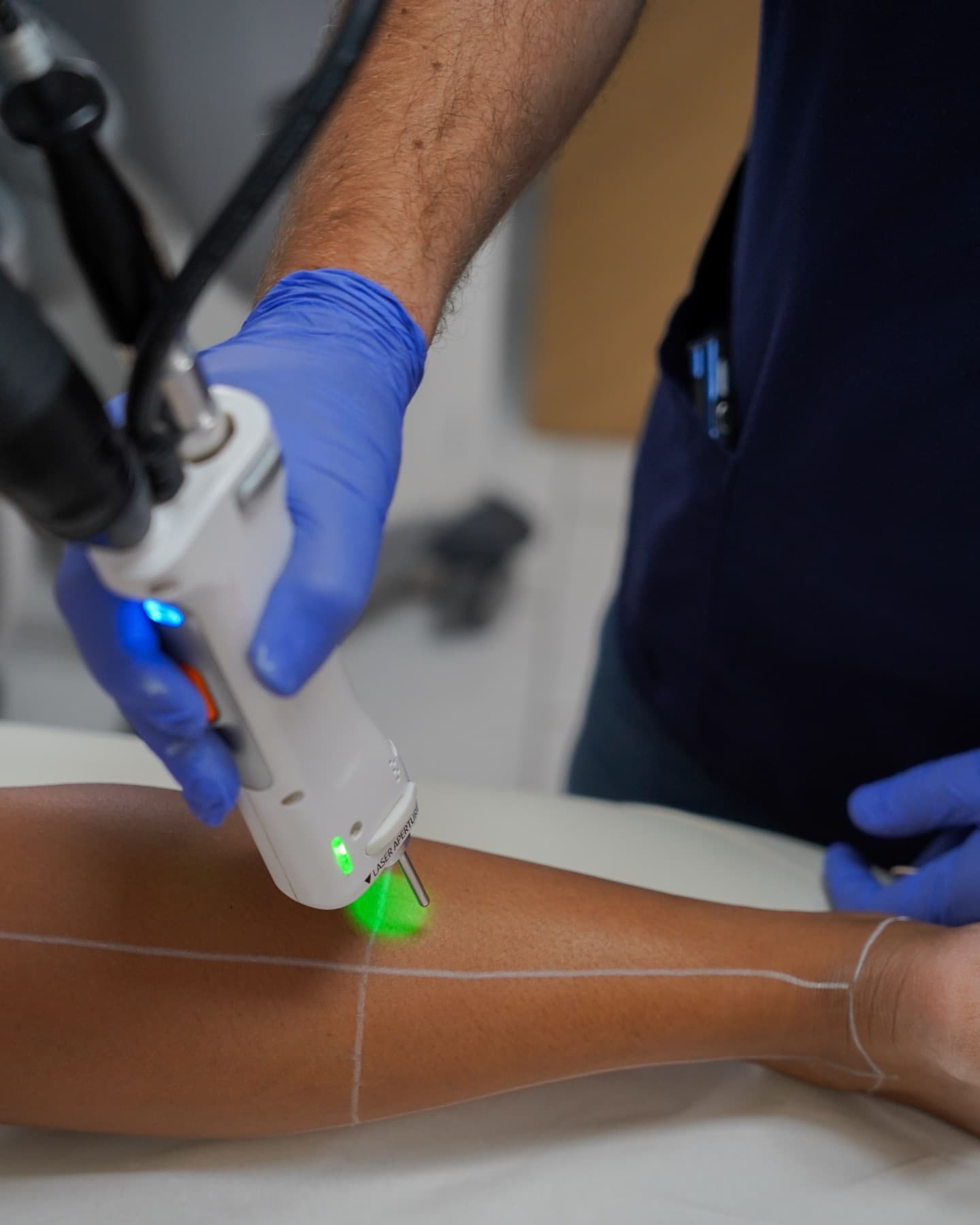 Impact du laser sur la jambe